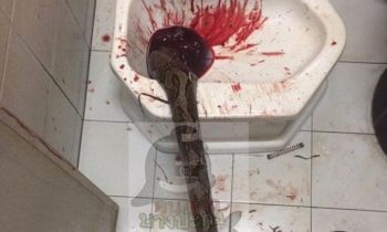 Python Crawls Up Toilet, Bites Man On Penis: He Fights For His Life