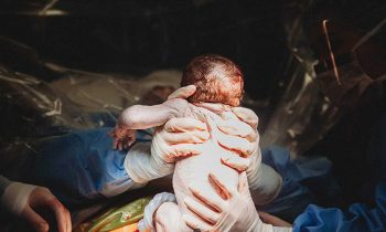 and#039;She Pulled The Baby Out Herself!and#039; Mom Delivers Her Own Baby Via C-Section